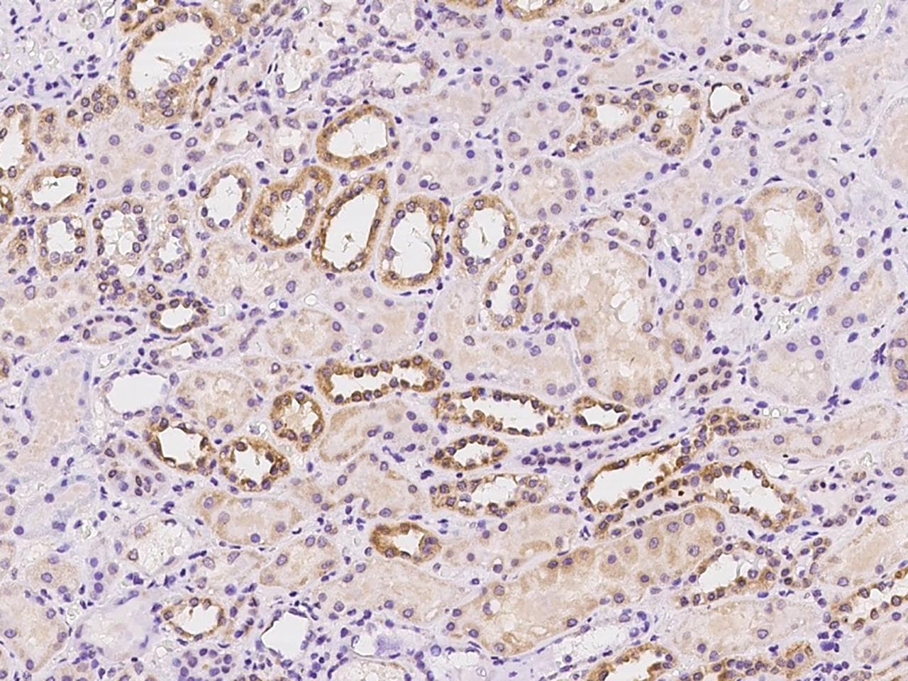 Polyclonal Rabbit anti-Human SIX4 Antibody (IHC, IF)