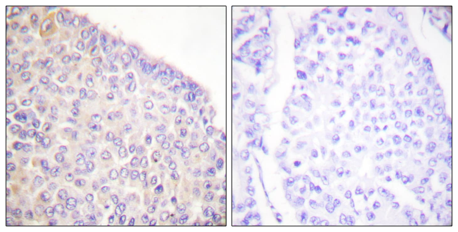 SYK Antibody (phospho-Tyr525)