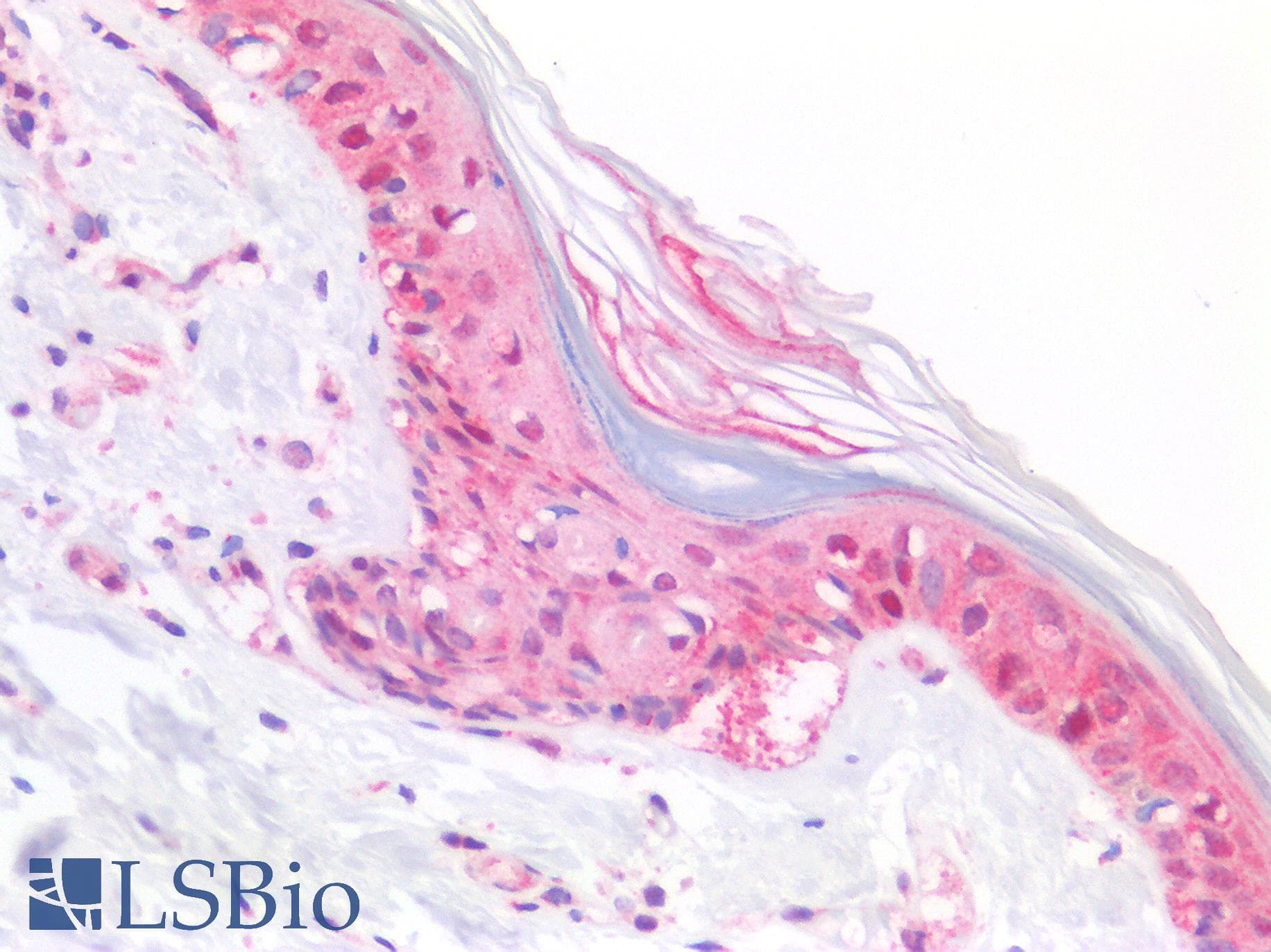 Polyclonal Rabbit anti-Human SRY Antibody (Internal, IHC, WB)