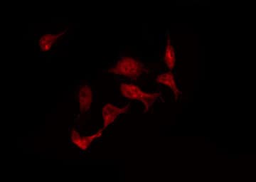 UBE1DC1 / UBA5 Antibody