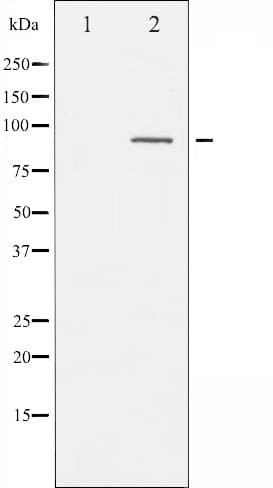 PRKCA / PKC-Alpha Antibody (phospho-Thr638)