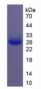 Human IL11 Protein (Recombinant His, N-Terminal)