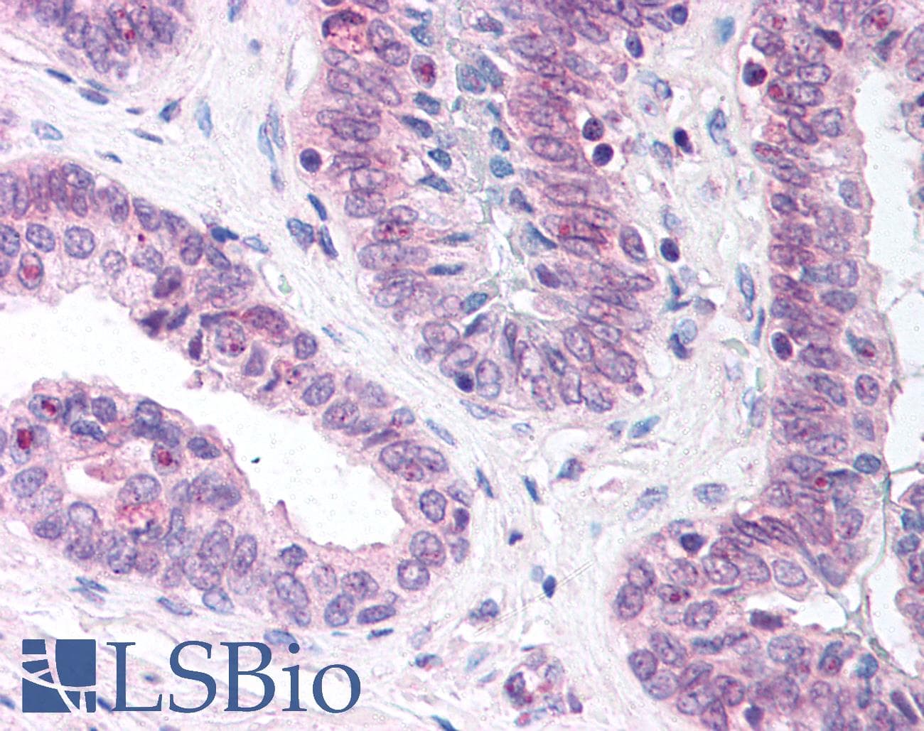 IHC-plus™ Polyclonal Rabbit anti-Human LCAT Antibody (C-Terminus, IHC, WB)