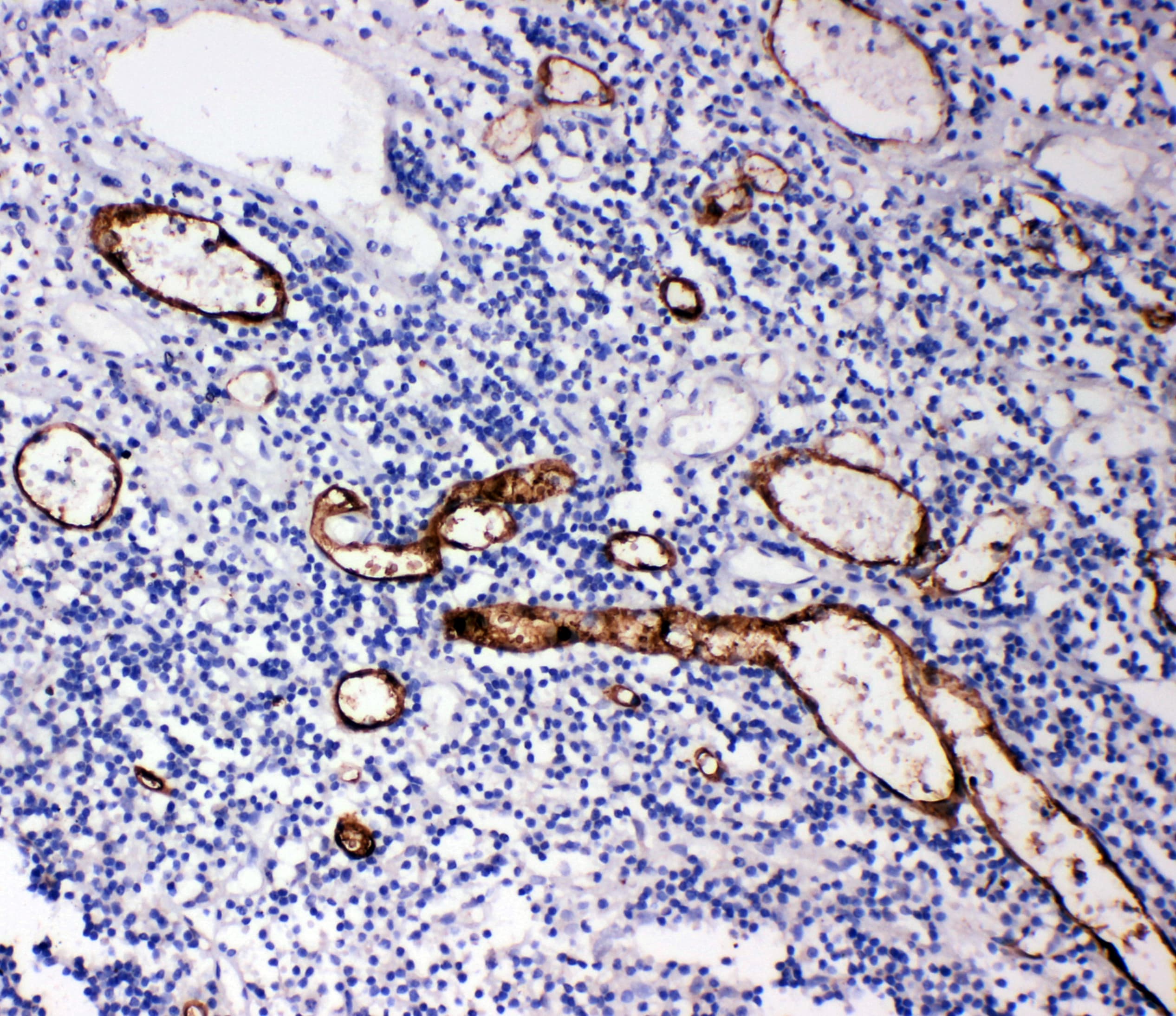 MAdCAM-1 Antibody (aa173-190)