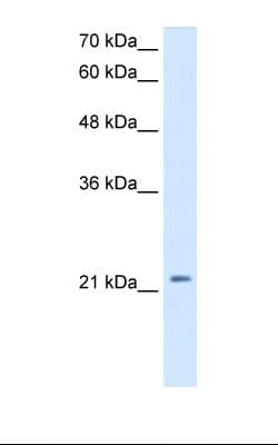 Polyclonal Rabbit anti-Human DKK1 Antibody (HRP, C-Terminus, WB)