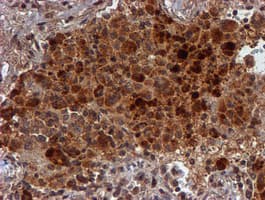 HARS2 Antibody (clone OTI5H2)