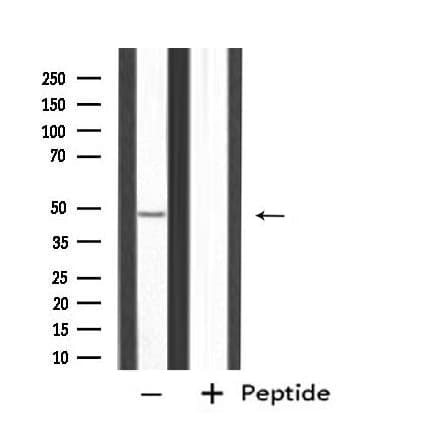 PPP2R2B Antibody