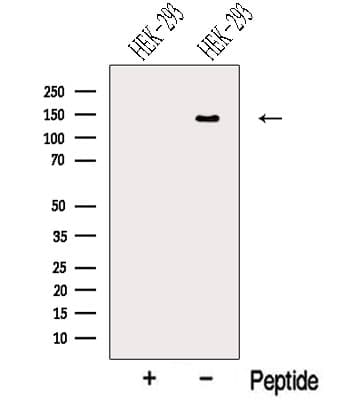 Polyclonal Rabbit anti-Human NRCAM Antibody (WB)