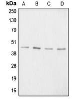 ACAN / Aggrecan Antibody (N-Terminus)
