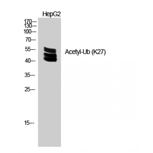 Ubiquitin Antibody (around the acetylation site of K27.)