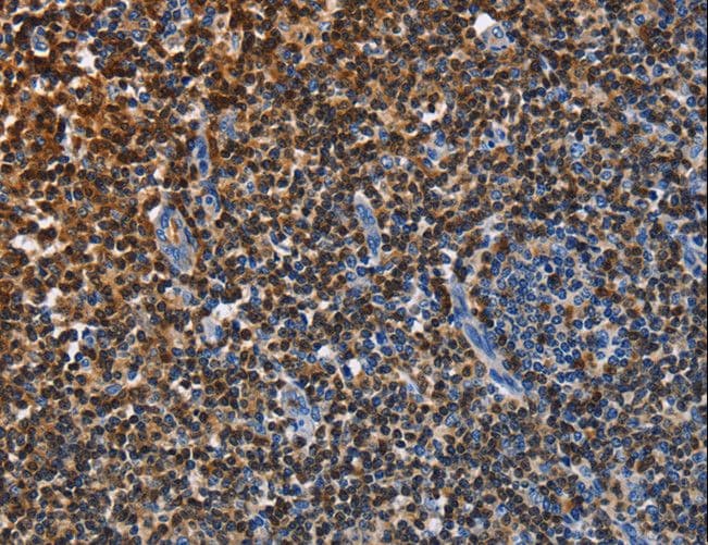 ENPP5 Antibody
