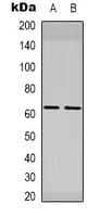 Polyclonal Rabbit anti-Human ELK1 Antibody (C-Terminus, IHC, WB)