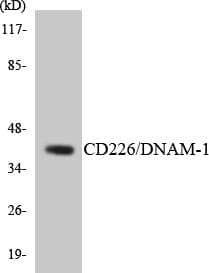 DNAM-1 / CD226 Antibody (aa276-325)