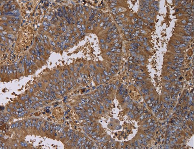 FADS1 Antibody