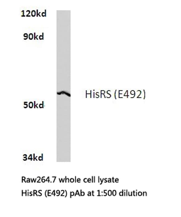 HARS Antibody (Glu492)