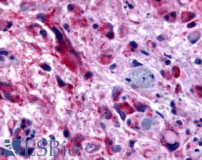 PathPlus™ CHRM2 / M2 Antibody (Cytoplasmic Domain)