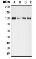 GRIA4 / GLUR4 Antibody (phospho-Ser862)
