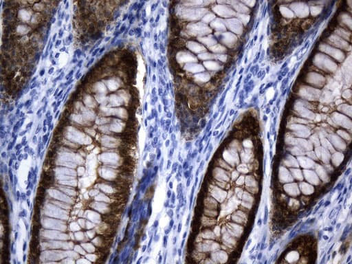 VIL1 / Villin Antibody (aa1-188, clone UMAB230)