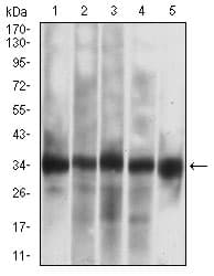 CASP7 / Caspase 7 Antibody (clone 4D10B2)