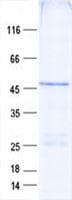 Human FAM53C Protein (Recombinant His, N-Terminal)