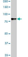 Monoclonal Mouse anti-Human DYRK / DYRK1A Antibody (clone 7D10, WB)