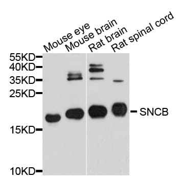 SNCB / Beta-Synuclein Antibody