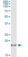 IL1RN Antibody (clone 1H5)