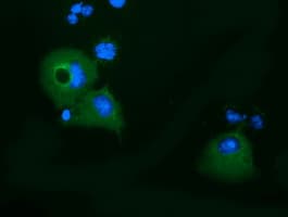 KLHL2 / MAV Antibody (clone OTI8B8)
