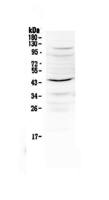 IL12B / IL12 p40 Antibody