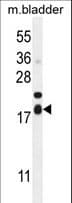 Polyclonal Rabbit anti-Human FAM162A / C3orf28 Antibody (aa118-146, WB)