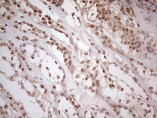 WTAP Antibody (aa2-106, clone OTI6H3)