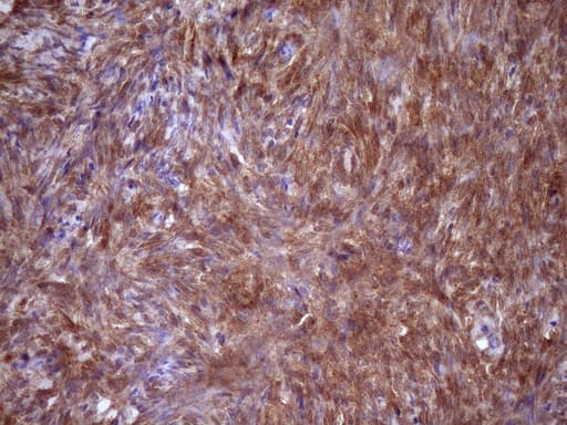 Monoclonal Mouse anti-Human FSCN1 / Fascin Antibody (clone OTI3B4, IHC, WB)