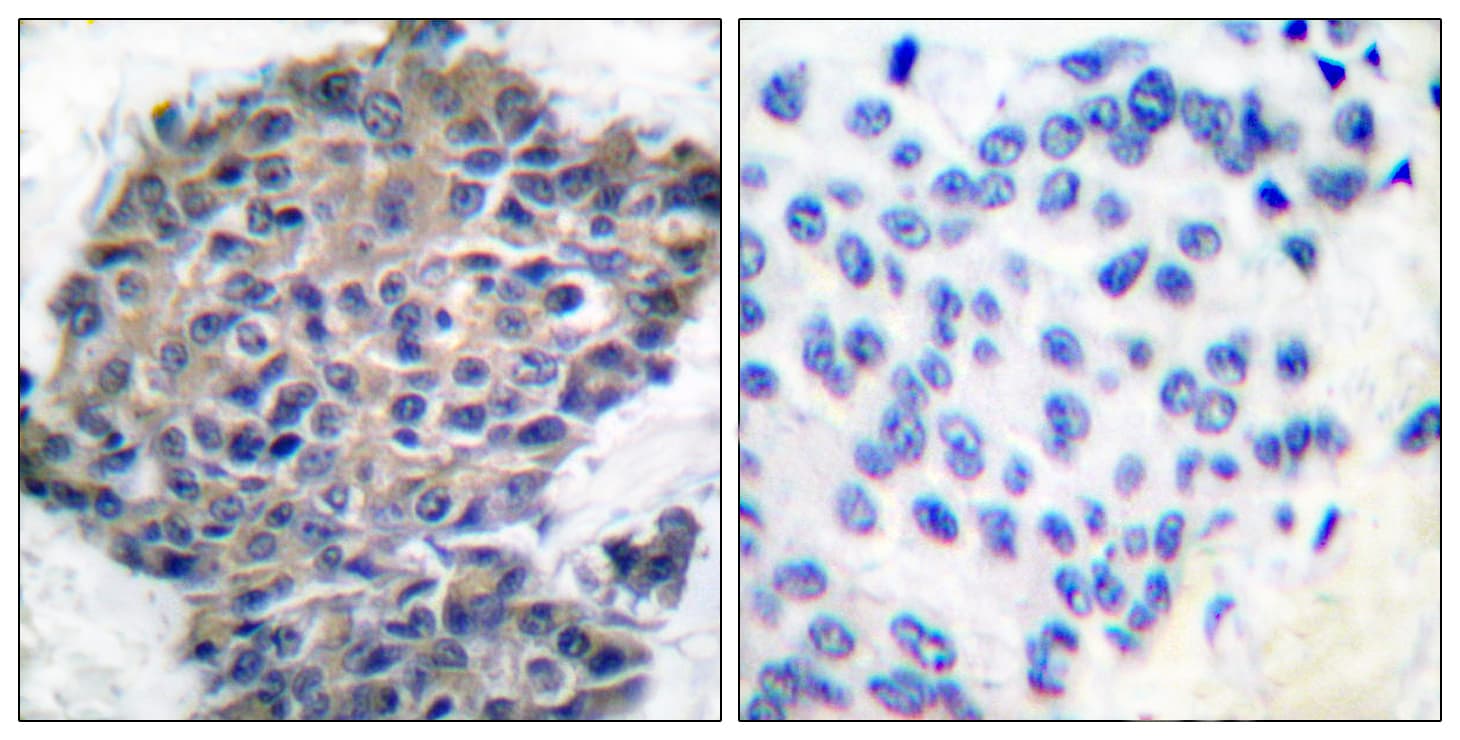 FLNA / Filamin A Antibody (phospho-Ser2152)