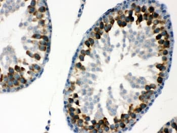 Polyclonal Rabbit anti-Human YBX1 / YB1 Antibody (IHC, WB)
