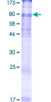 Human SLC6A8 Protein (Recombinant GST)