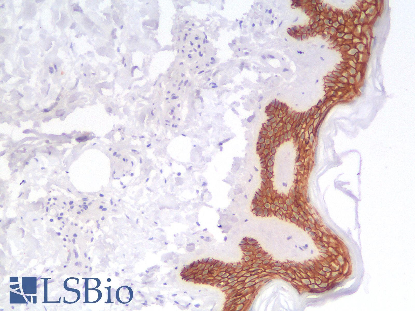PathPlus™ CDH1 / E Cadherin Antibody (clone rCDH1/1525)