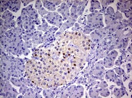 Monoclonal Mouse anti-Human PR / Progesterone Receptor Antibody (clone OTI11E8, aa1-298, IHC, WB)