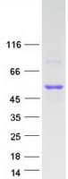 Human LIPF / GL / Gastric Lipase Protein (Recombinant Myc-DDK (Flag))