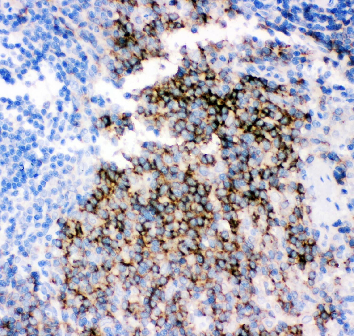 CD79B / CD79 Beta Antibody (aa29-229)