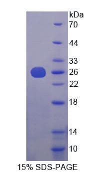 Mouse HPS4 Protein (Recombinant His-T7)