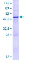 Human HAUS2 Protein (Recombinant GST)