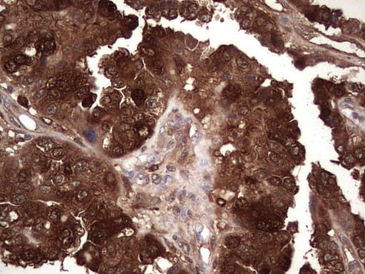 LGALS3 / Galectin 3 Antibody (clone OTI7G9, Carrier-free)