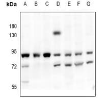 PRKCA / PKC-Alpha Antibody