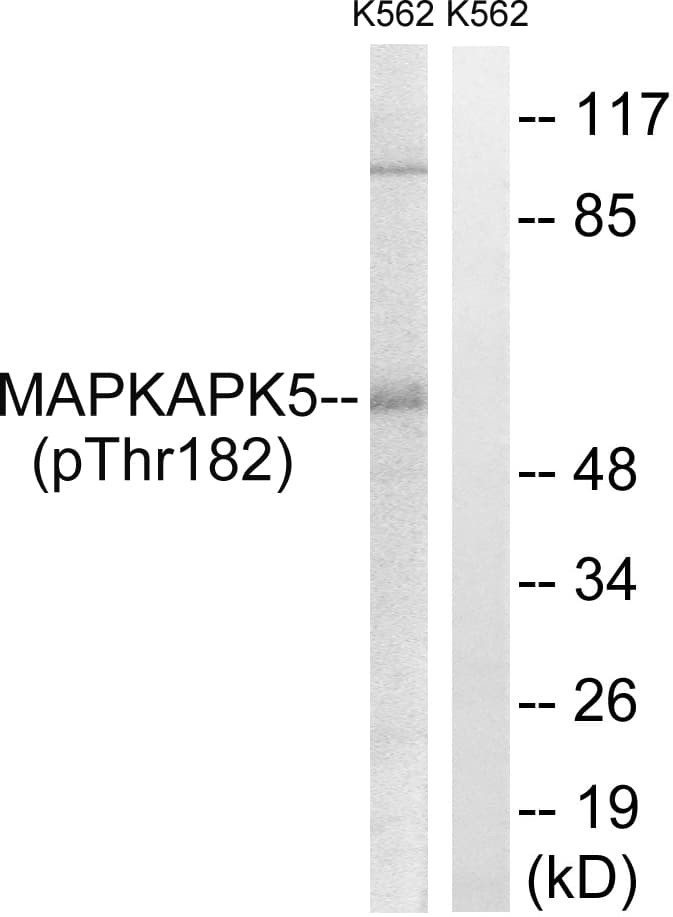 Polyclonal Rabbit anti-Human MAPKAPK5 / PRAK Antibody (phospho-Thr182, IHC, WB)