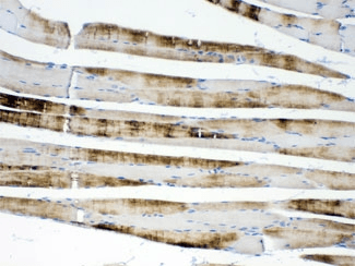 Polyclonal Rabbit anti-Human ACTN3 Antibody (IHC, WB)