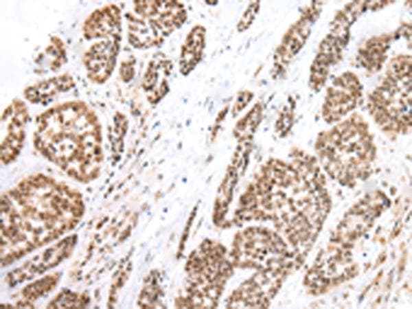 Polyclonal Rabbit anti-Human BF1 / FOXG1 Antibody (IHC, WB)