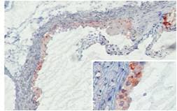 MBL2 / Mannose Binding Protein Antibody (clone 14D12)