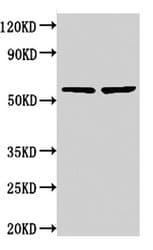 Polyclonal Rabbit anti-Human NOP58 / NOP5 Antibody (WB)