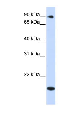 Polyclonal Rabbit anti-Human TSR1 Antibody (aa648-697, WB)