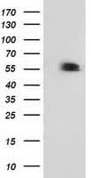 TP53 / p53 Antibody (clone OTI2A4)